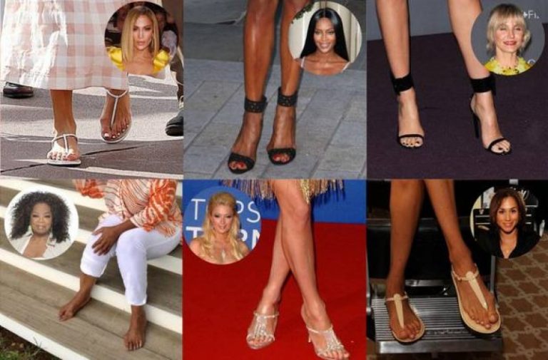 30 Celebrities With Bunions You’d Never Expect