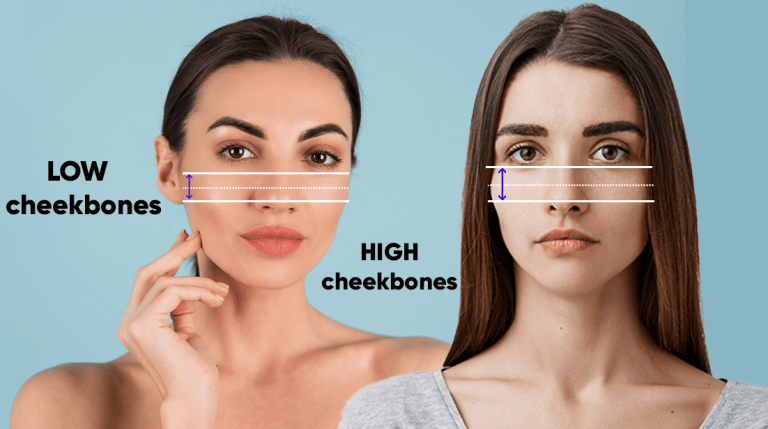 Causes and treatments for high cheekbones versus low cheekbones